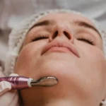 Mesotherapy for the face: The best non-surgical cosmetic technique