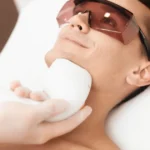 Benefits of Fractional Laser for the Face: What Can It Do?