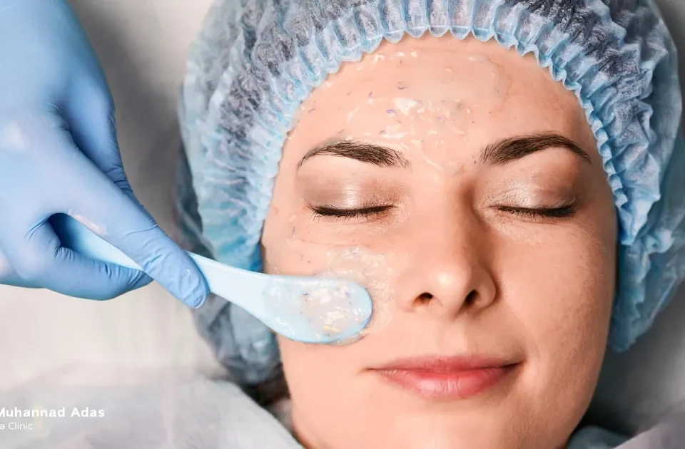 Chemical Peeling: The Optimal Solution for Various Skin Problems